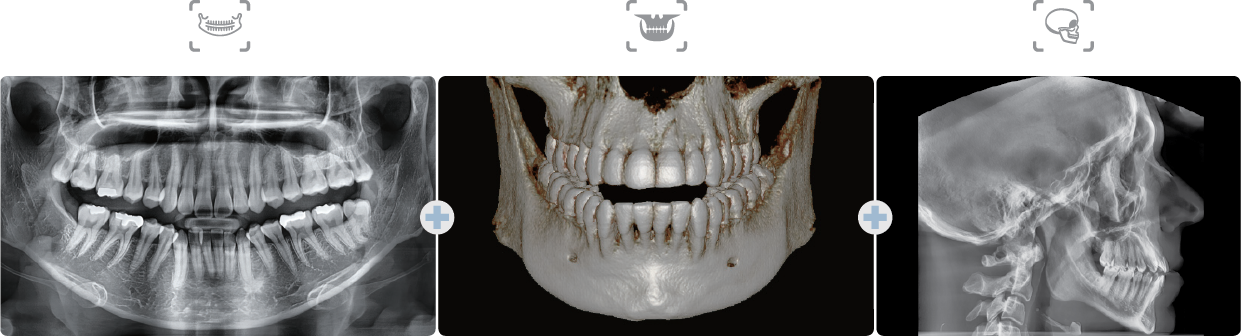 Green X 21 CT 파노라마 세팔로 동시 촬영