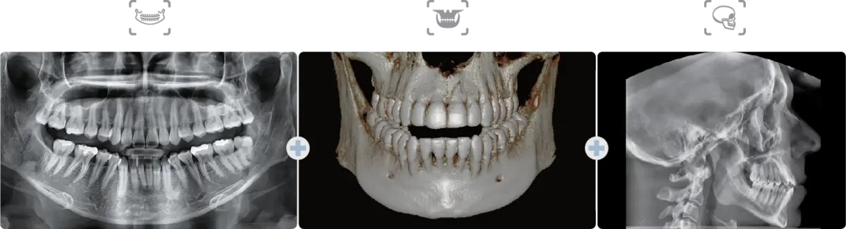 Green X 21 CT 파노라마 세팔로 동시 촬영