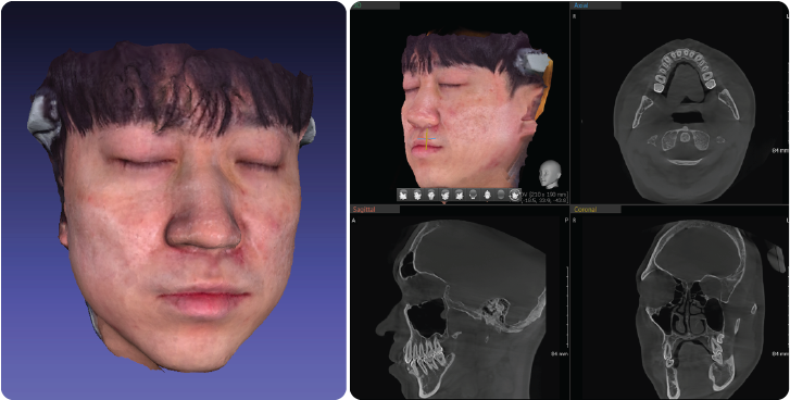 Green X 21 Face Scan 안면 3D 스캔