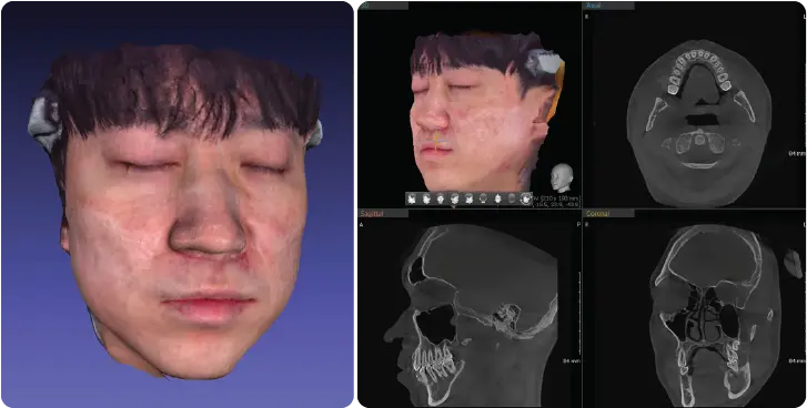 Green X 21 Face Scan 안면 3D 스캔