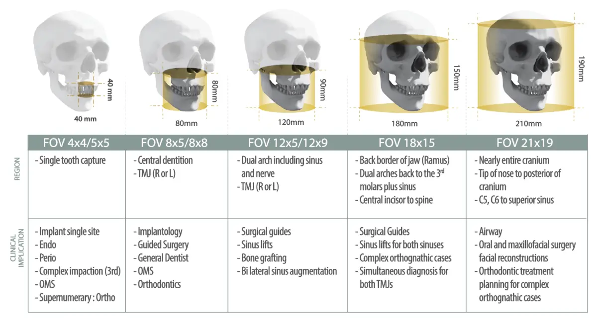 Green X 21 다중 FOV 8단계 촬영 범위