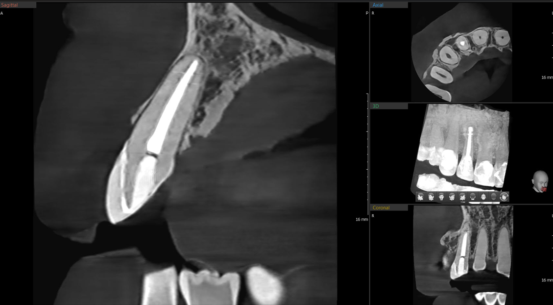 CBCT 축면 영상 샘플