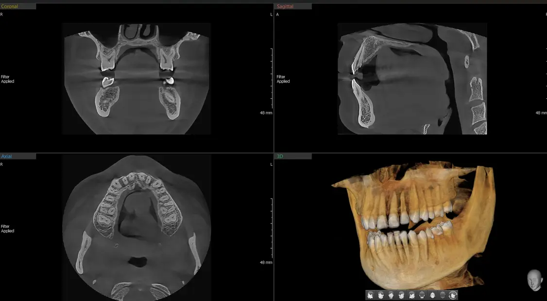 기타의료기기 관련 이미지